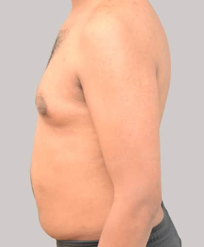 82119 Before Image