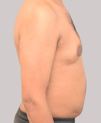 82119 Before Image