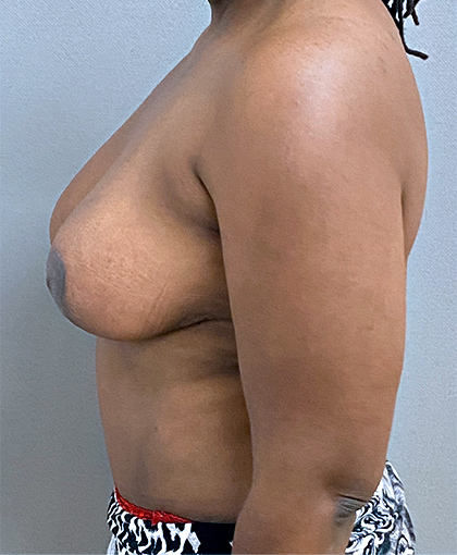 7397 After Image