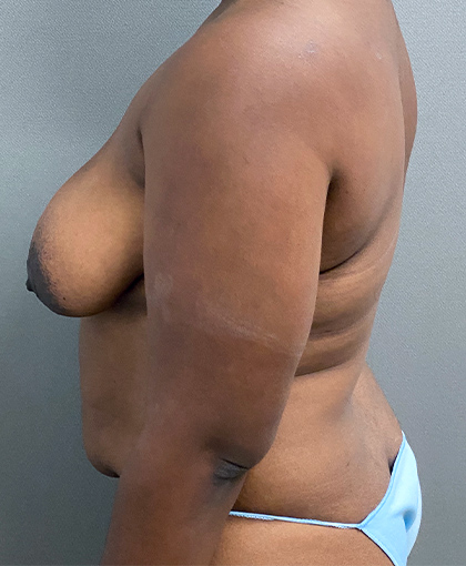 7397 Before Image