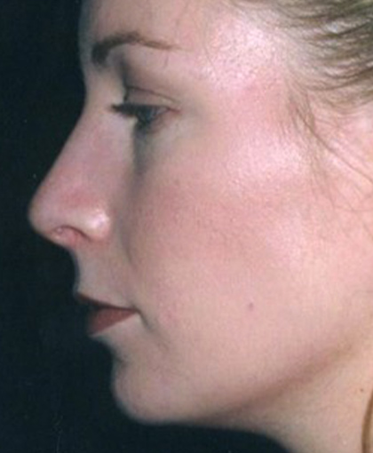 3043 After Image