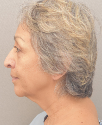 2972-20 Before Image