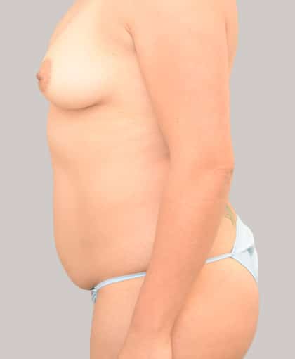 5030 Before Image