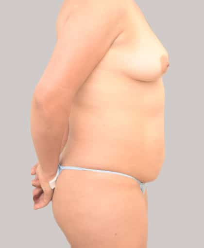 5030 Before Image