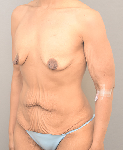 56599 Before Image