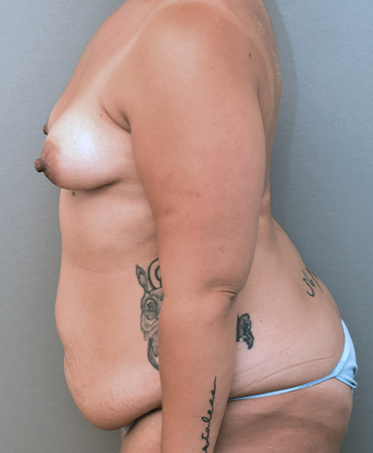 8848 Before Image