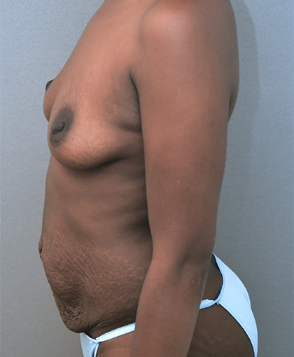 2346 Before Image