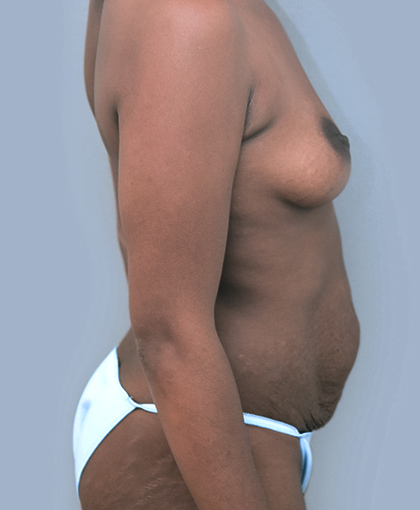 2346 Before Image