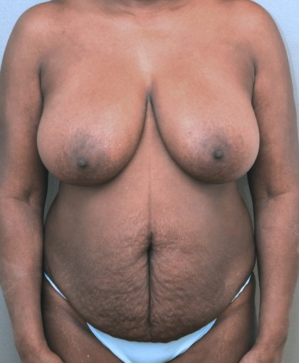 2865 Before Image