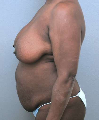 2865 Before Image