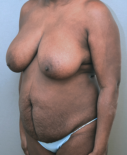 2865 Before Image