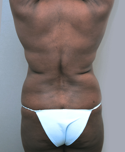 2865 Before Image