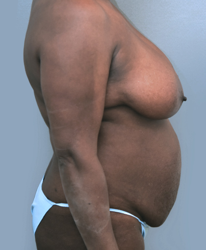 2865 Before Image