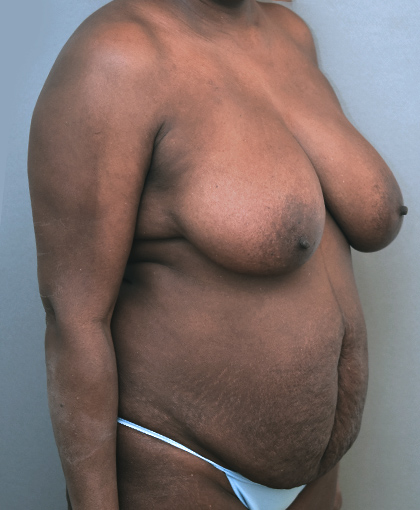 2865 Before Image
