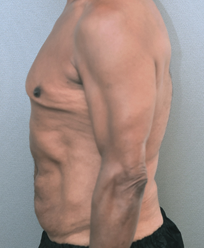 6632 Before Image