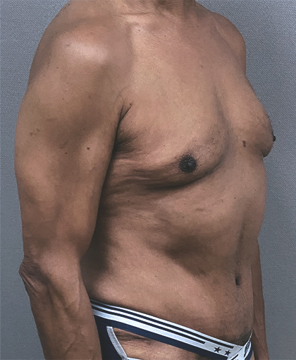 6632 After Image