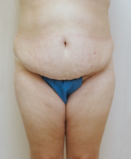 6987 Before Image