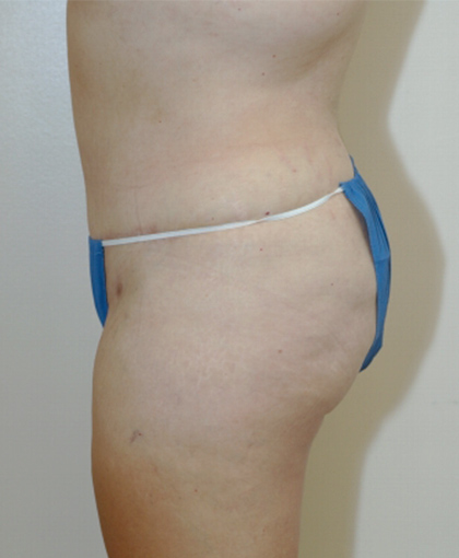 6987 After Image