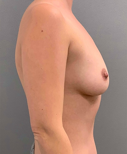 4534 Before Image