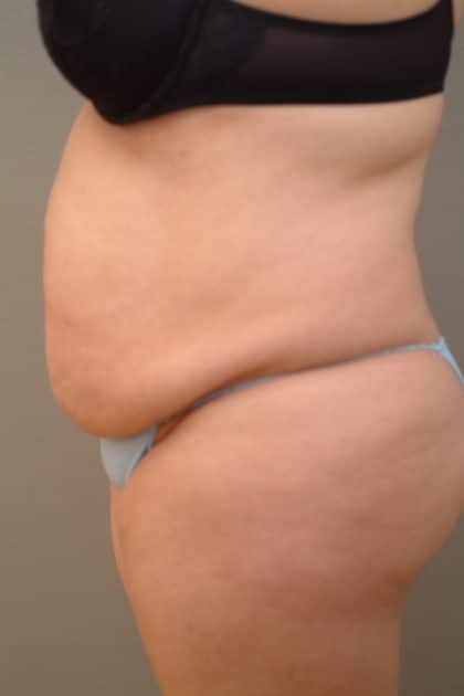 11242 Before Image