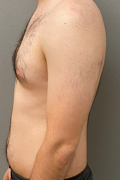 67236 Before Image