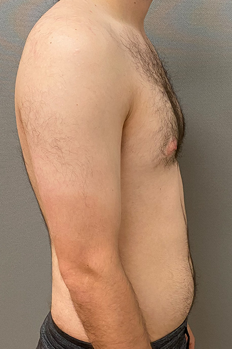 67236 Before Image