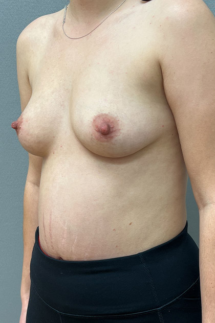 4237-10 Before Image