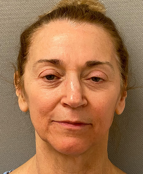 4664-20 Before Image