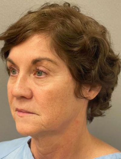 8528-10 Before Image