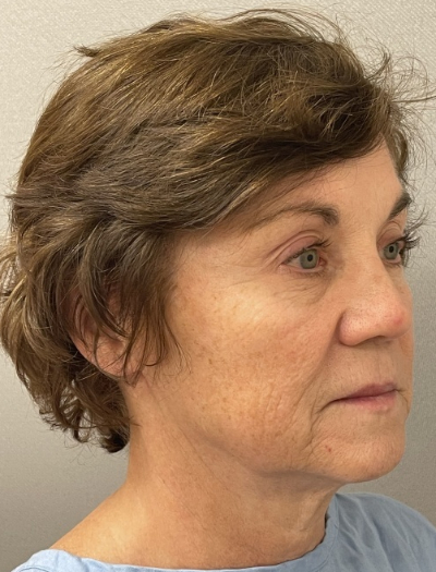 8528-10 Before Image