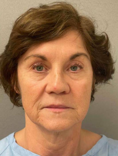 8528-10 Before Image