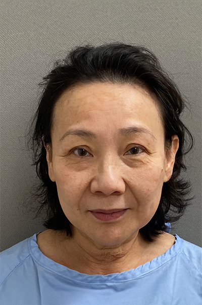 7723-20 Before Image