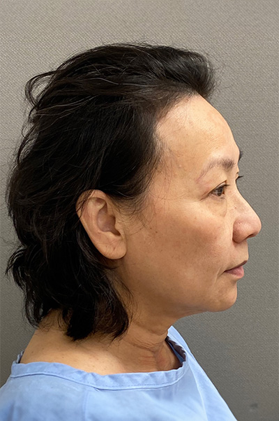 7723-20 Before Image