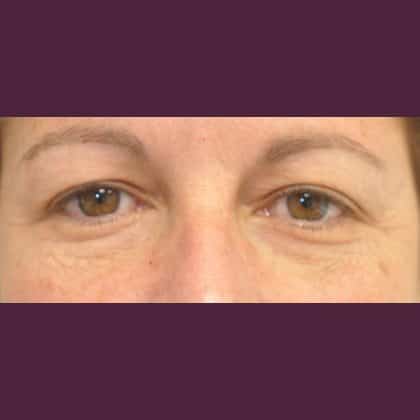 8798 Before Image