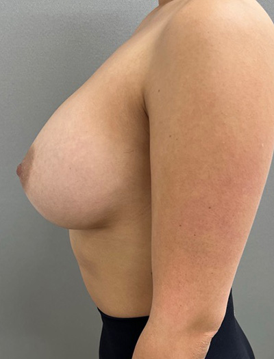5655 After Image