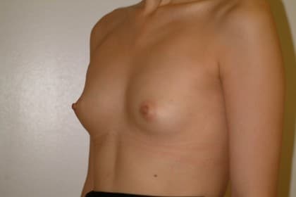 10758 Before Image