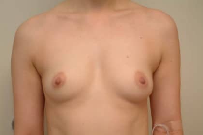 8393 Before Image