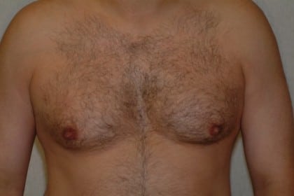 6838 Before Image