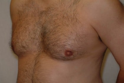 6838 Before Image