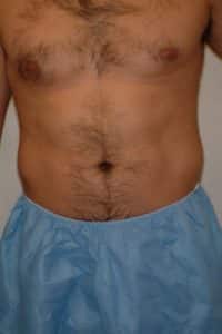 78499 Before Image