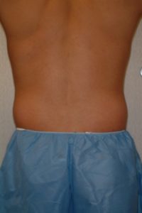 78499 Before Image