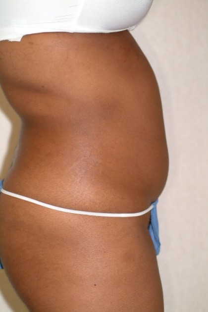 7571 Before Image