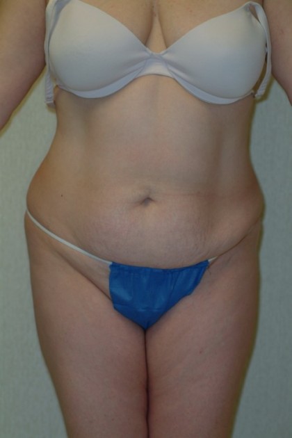 7562 Before Image