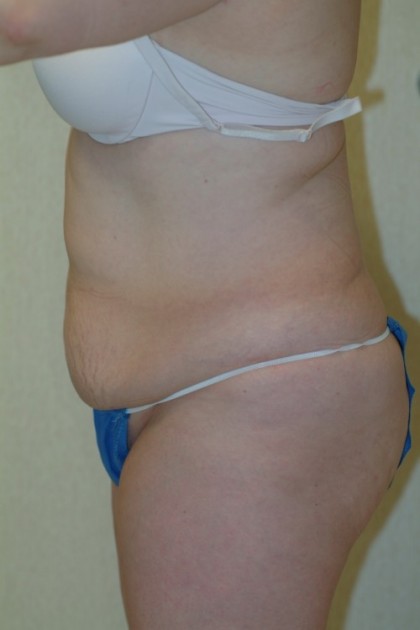 7562 Before Image