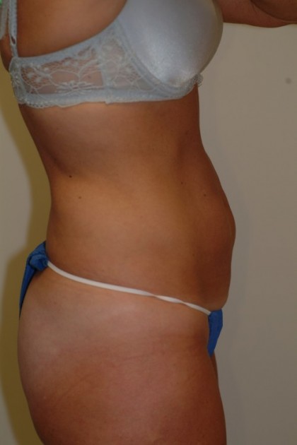 7424 Before Image
