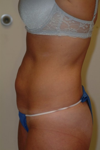 7424 Before Image