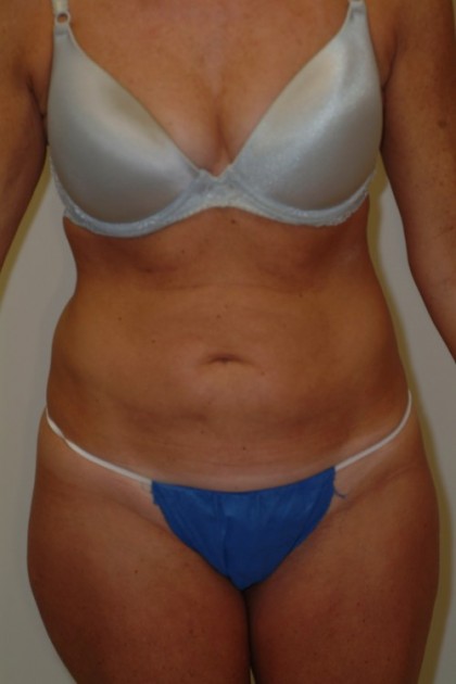 7424 Before Image