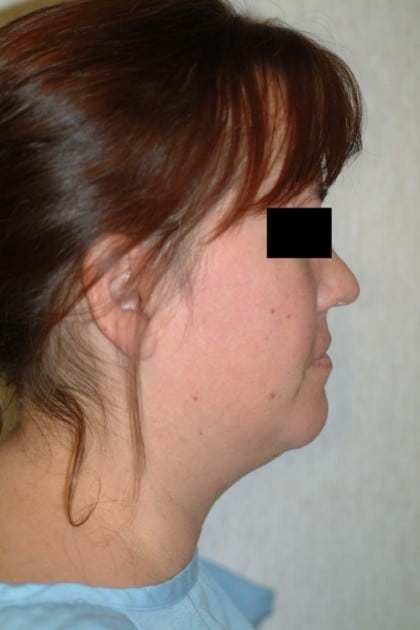 6515 Before Image