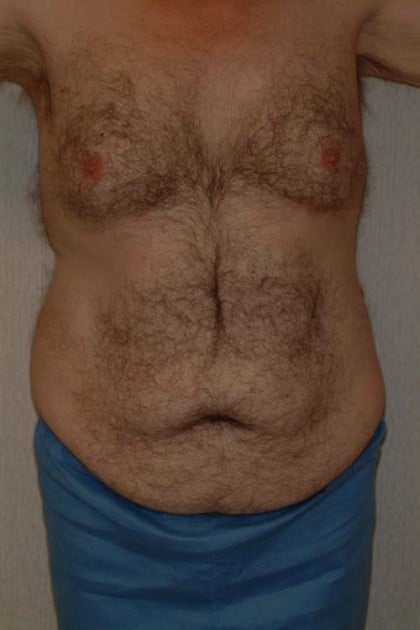 6548 Before Image