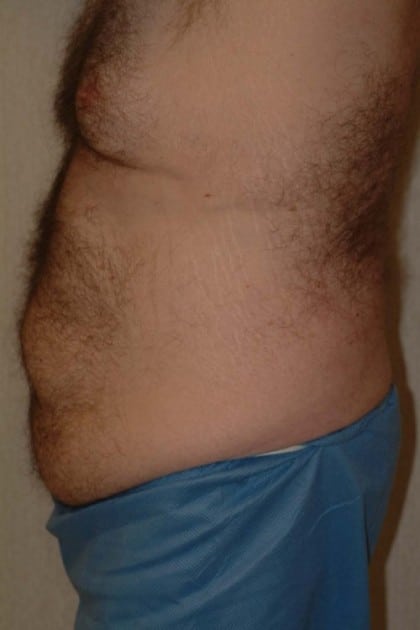 6548 Before Image
